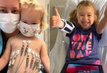 Inteligência artificial auxilia mãe a identificar diagnóstico raro da filha após peregrinação médica