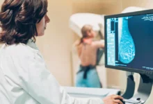 Mudanças no estilo de vida impulsionam diagnósticos de câncer de mama em mulheres jovens