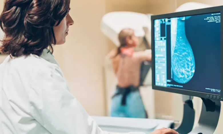 Mudanças no estilo de vida impulsionam diagnósticos de câncer de mama em mulheres jovens