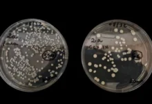 Nova fórmula com clorexidina e óleos naturais combate fungo hospitalar resistente