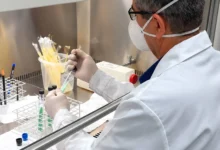 Novo método de diagnóstico da tuberculose simplifica exames e reduz custos