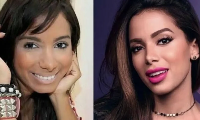 Anitta relembra pressões estéticas no início da carreira e admite cirurgias para atingir sucesso