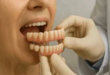 Cidade goiana alcança marca expressiva na distribuição de próteses dentárias gratuitas