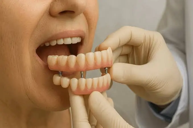 Cidade goiana alcança marca expressiva na distribuição de próteses dentárias gratuitas