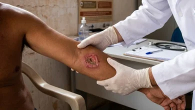 Cientistas da USP desenvolvem nova estratégia molecular contra a leishmaniose cutânea