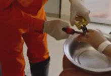 Corpo de Bombeiros realiza resgate delicado de aliança presa em dedo de paciente