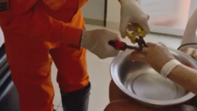 Corpo de Bombeiros realiza resgate delicado de aliança presa em dedo de paciente