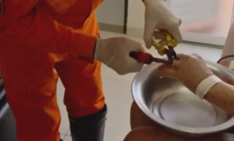 Corpo de Bombeiros realiza resgate delicado de aliança presa em dedo de paciente