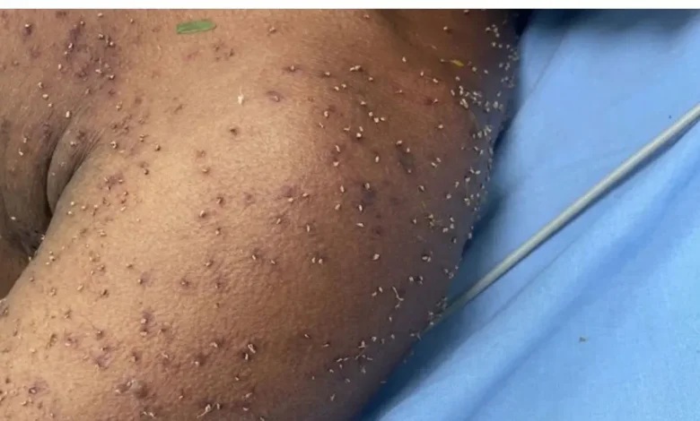 Morador surdo é socorrido inconsciente depois de ataque de abelhas em Itapuranga