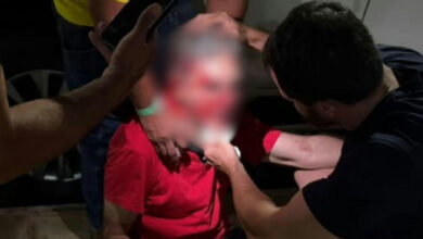Pastor espancado após usar camiseta vermelha aguarda cirurgia no nariz
