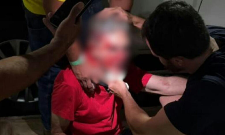 Pastor espancado após usar camiseta vermelha aguarda cirurgia no nariz