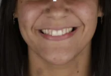 Prisão em trindade após golpe de cristais nos dentes e falso PIX