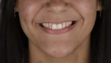 Prisão em trindade após golpe de cristais nos dentes e falso PIX