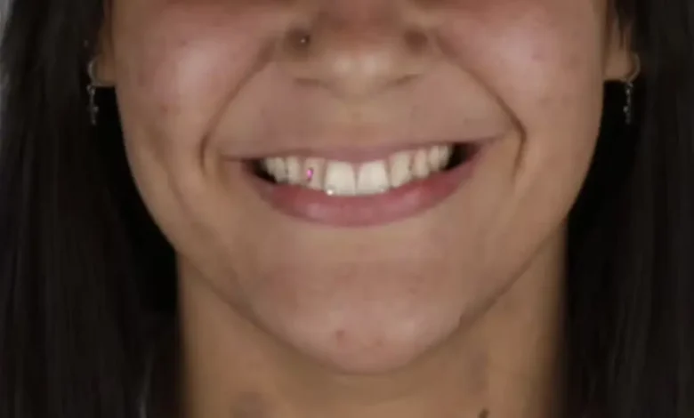 Prisão em trindade após golpe de cristais nos dentes e falso PIX