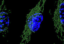 Proteína Hif-1α acelera resposta imune e reprograma energia de macrófagos
