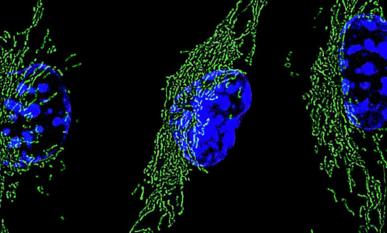 Proteína Hif-1α acelera resposta imune e reprograma energia de macrófagos