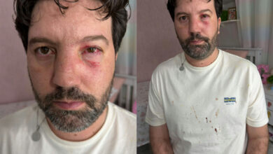 Radialista sofre agressão física durante cobertura esportiva em São Luís de Montes Belos