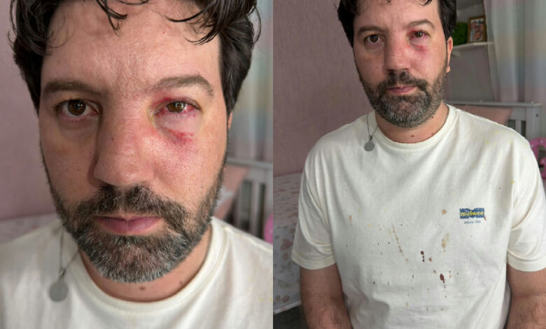 Radialista sofre agressão física durante cobertura esportiva em São Luís de Montes Belos