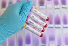 Saúde de Goiás reforça importância do diagnóstico precoce de infecções sexualmente transmissíveis