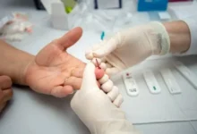 Sífilis avança em Goiás com quase 8 mil casos registrados apenas em 2026