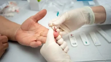Sífilis avança em Goiás com quase 8 mil casos registrados apenas em 2026