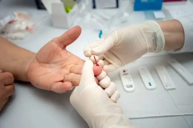 Sífilis avança em Goiás com quase 8 mil casos registrados apenas em 2026