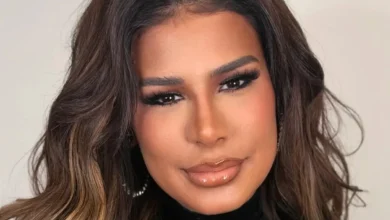 Simone Mendes rebate críticas sobre rinomodelação e pede liberdade aos seguidores